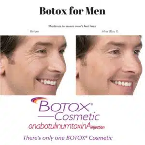 Botox for men 300x300 1.jpg