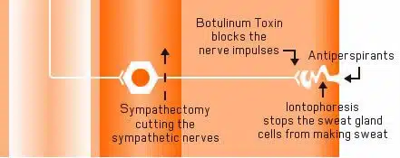 How Botox Works to Block Nerve 1.jpg